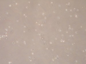 semen-analisis-espermatozioides